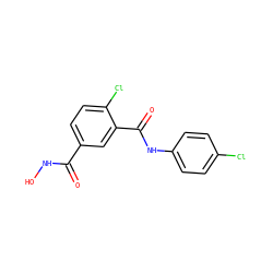 O=C(NO)c1ccc(Cl)c(C(=O)Nc2ccc(Cl)cc2)c1 ZINC001772588091